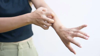 Acționează rapid contra pielii iritate astfel încât să nu se înrăutățească