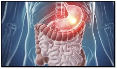 Alertă! Microplasticele din aer sunt suspectate că provoacă cancer pulmonar și de colon!