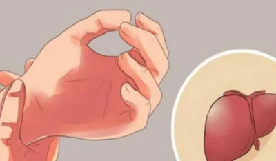 Alertă pentru sănătate! 11 semne că ficatul tău este grav deteriorat!