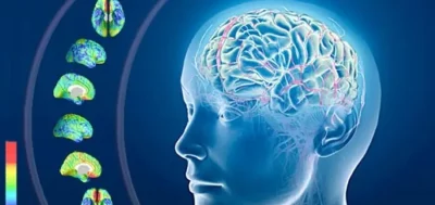 Maladia Alzheimer afectează aproape 50 de milioane la nivel mondial! Ce trebuie să știi despre simptome și diagnostic