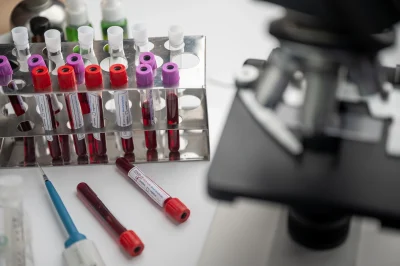 Studiu suedez dezvăluie biomarkerii surprinzători care îți pot asigura 100 de ani