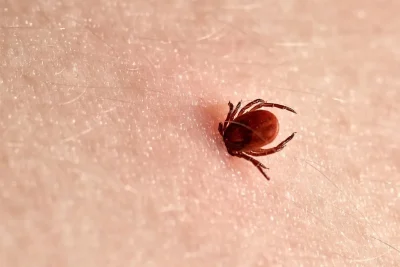 Cum scapi rapid de boala Lyme după mușcătura de căpușă – tratamentul simplu care te salvează!