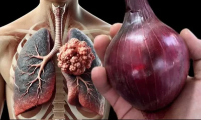 Oprește tusea în doar 3 zile cu acest remediu pe bază de ceapă