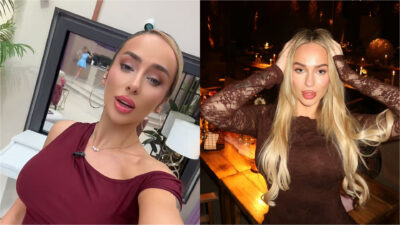 Theodora de la Casa Iubirii s-a tunat. Cum arată concurenta după ce și-a injectat acid hialuronic în față