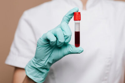 Boala cumplită la care ești expus în funcție de grupa de sânge. Ce spun medicii despre românii cu grupa A sau 0