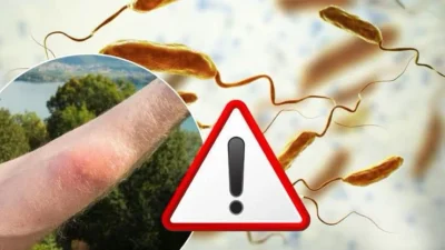 Bacteria letală care se înmulțește în apele calde a provocat numeroase decese în SUA